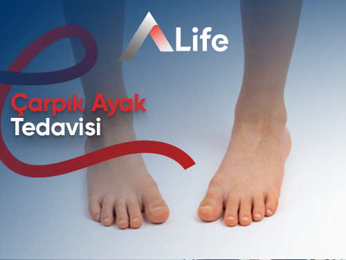 Çarpık Ayak Tedavisi